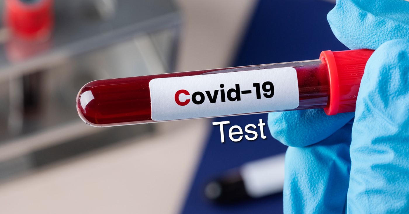 एकैदिन ५७ जनामा कोरोना संक्रमण, संक्रमितको संख्या १९१ पुग्यो