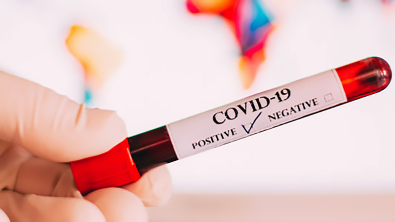 गण्डकी प्रदेशका तीन जना सांसद र एक जना कर्मचारीमा कोरोना संक्रमण पुष्टि