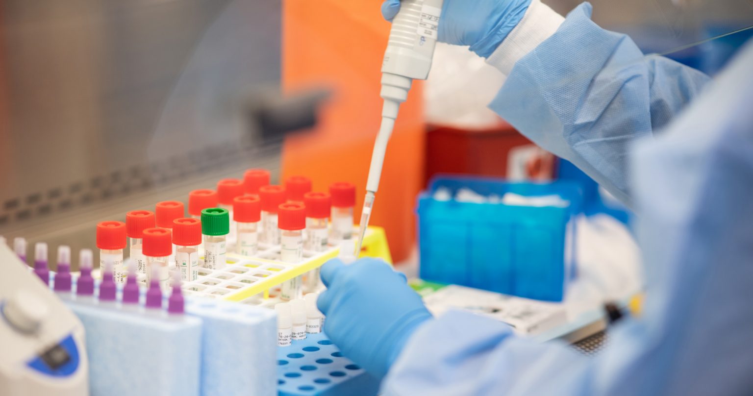 कोरोना संक्रमणबाट आज १९३ जनाको मृत्यु, ७ हजार ९१४ जना संक्रमित थपिए