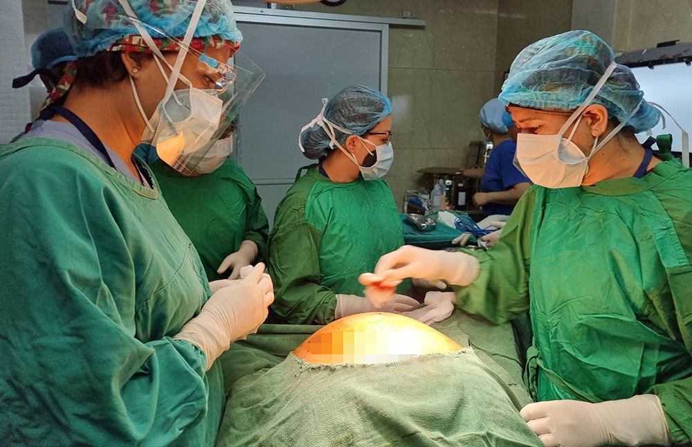 भक्तपुर क्यान्सर अस्पतालमा  निकालियो पेटबाट ३५ किलोको ट्युमर