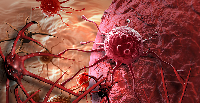 साथ पाए जित्न सकिन्छ क्यान्सर