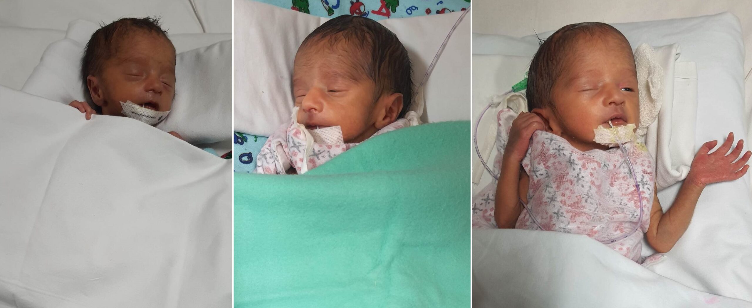 निसन्तान दम्पत्तिको खुशी: रेखादेवीले जन्माइन ‘तिम्ल्याहा’ बच्चा