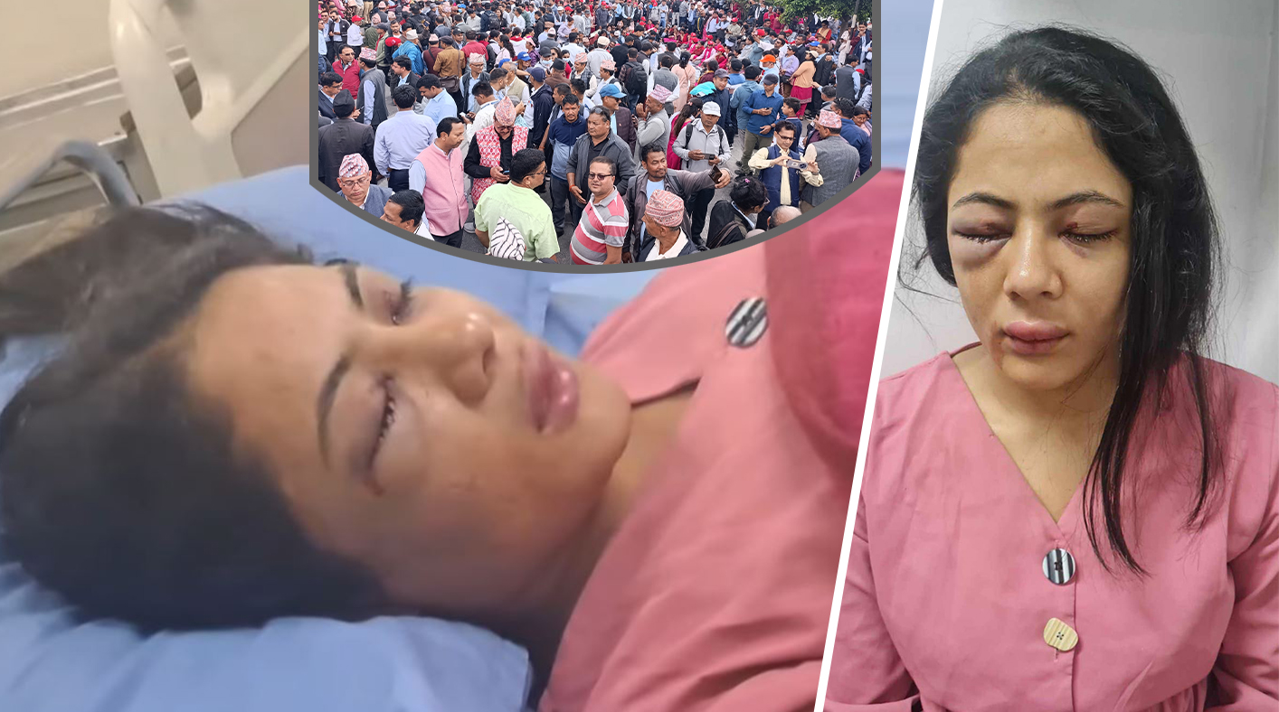 झडपमा शिक्षक, प्रहरी र पत्रकारसहित २६ जना घाइते