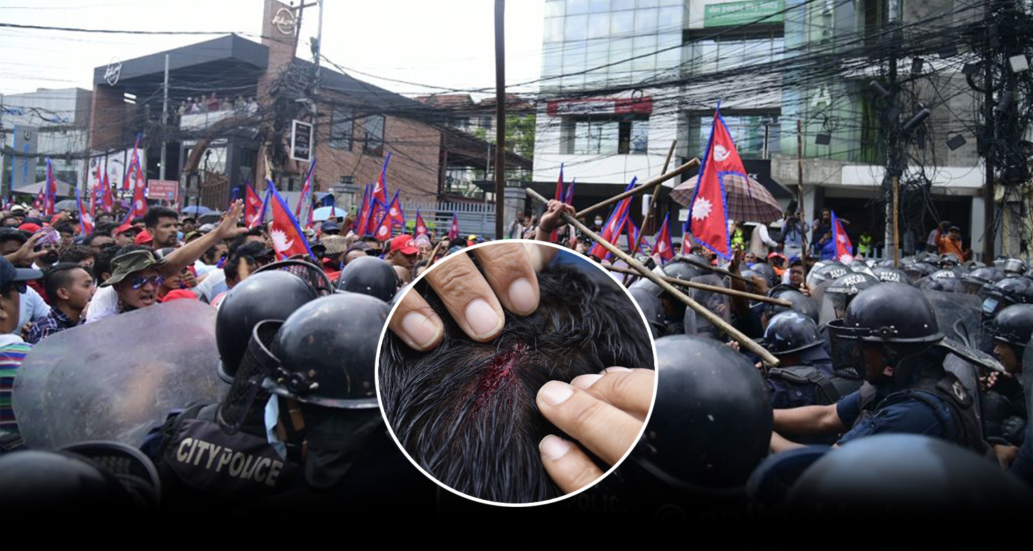 राजावादीको प्रदर्शनमा प्रहरीद्वारा लाठीचार्ज, केही घाइते