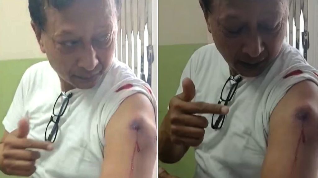 कान्तिपुर टीभीका पत्रकारलाई लाग्यो गोली