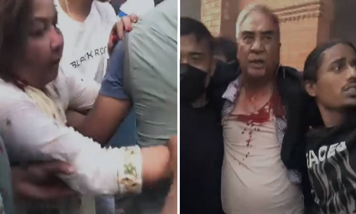 देउवा दम्पती कहिले हुन्छन् अस्पतालबाट डिस्चार्ज ? अस्थायी बसोबास कहाँ