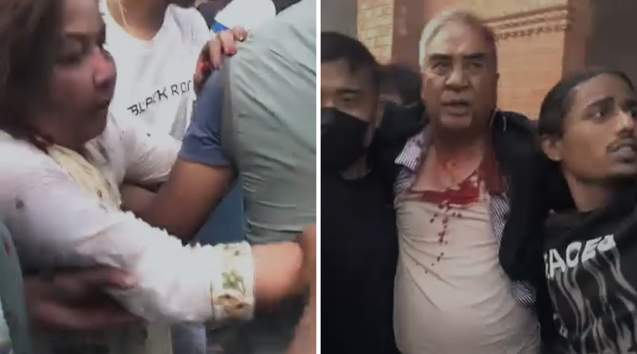 देउवा दम्पतीको अस्पतालमा उपचार हुँदै, दुवैको टाउकोमा धारिलो हतियारको प्रहार